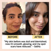 Gua Sha Facial Massage Stone Beauty Skincare Tool